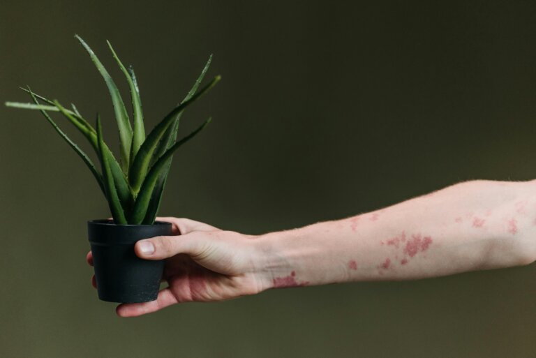 Hand with eczema-prone skin gently holding a plant, symbolizing skin sensitivity and healing